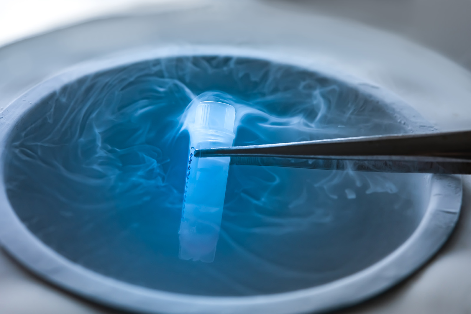 Workshop: Ovarian Tissue Cryopreservation &amp; Transp.